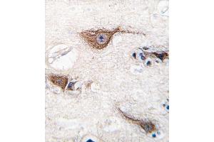 Immunohistochemistry (IHC) image for anti-Ubiquitin Carboxyl-terminal Esterase L1 (Ubiquitin Thiolesterase) (UCHL1) antibody (ABIN3001459) (UCHL1 antibody)