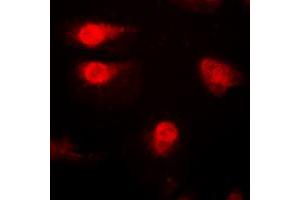 Immunofluorescent analysis of p27 Kip1 (pT187) staining in A431 cells. (CDKN1B antibody  (C-Term, pSer187))