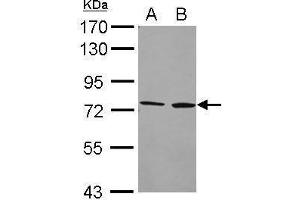 WB Image Sample (20 ug) A: Hela whole cell lysate B: Hela cell membrane 7. (CYP4F2 antibody  (Internal Region))