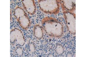Used in DAB staining on fromalin fixed paraffin- embedded stomach tissue (Fibrillin 3 antibody  (AA 403-667))