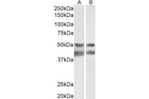 Image no. 1 for anti-E2F Transcription Factor 4, P107/p130-Binding (E2F4) antibody (ABIN5900178) (E2F4 antibody)