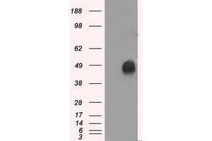 HEK293T cells were transfected with the pCMV6-ENTRY control (Left lane) or pCMV6-ENTRY ERCC1 (Right lane) cDNA for 48 hrs and lysed. (ERCC1 antibody)