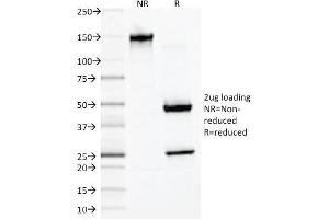 SDS-PAGE Analysis of Purified Desmin Monoclonal Antibody (DES/1711). (Desmin antibody)