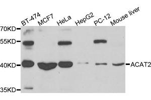 Western blot analysis of extracts of various cells, using ACAT2 antibody. (ACAT2 antibody)