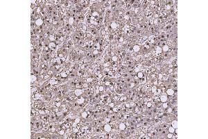 IHC analysis of TRIR using anti-TRIR antibody (ABIN7603244). (Uncharacterized Protein C19orf43 (TRIR) (N-Term) antibody)