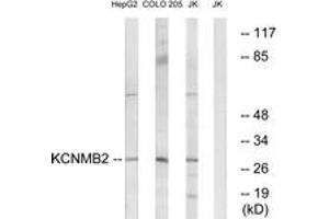 Western blot analysis of extracts from Jurkat/COLO/HepG2 cells, using KCNMB2 Antibody. (KCNMB2 antibody  (AA 151-200))