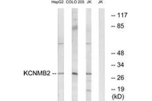 Western Blotting (WB) image for anti-Potassium Large Conductance Calcium-Activated Channel, Subfamily M, beta Member 2 (KCNMB2) (AA 151-200) antibody (ABIN1534708)
