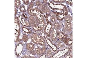 Immunohistochemical staining of human kidney with NARFL polyclonal antibody  shows strong cytoplasmic positivity in distal tubules at 1:200-1:500 dilution.