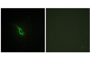 Immunofluorescence analysis of NIH/3T3 cells, using Adrenergic Receptor alpha -2A antibody.