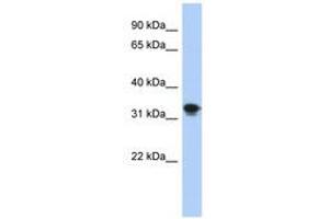 Image no. 1 for anti-Centromere Protein P (CENPP) (AA 35-84) antibody (ABIN6741259) (CENPP antibody  (AA 35-84))