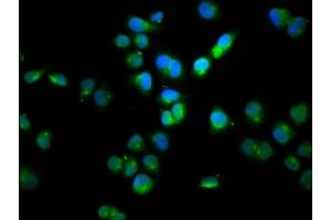 Immunofluorescence staining of Hela cells with ABIN7165976 at 1:100, counter-stained with DAPI. (SSH1 antibody  (AA 928-1049))