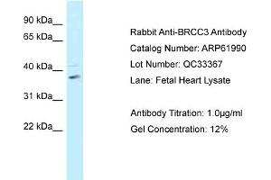 Western Blotting (WB) image for anti-BRCA1/BRCA2-Containing Complex, Subunit 3 (BRCC3) (C-Term) antibody (ABIN2788976) (BRCC3 antibody  (C-Term))