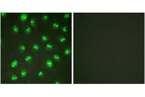 Immunofluorescence analysis of HuvEc cells, using p57 Kip2 (Ab-310) Antibody. (CDKN1C antibody  (AA 267-316))