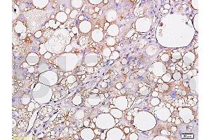 Formalin-fixed and paraffin embedded: rat liver labeled with Anti-Leptin Polyclonal Antibody (ABIN725030), Unconjugated 1:300 followed by conjugation to the secondary antibody and DAB staining (Leptin antibody  (AA 101-154))