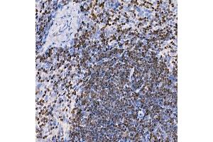 Immunohistochemistry (IHC) image for anti-IKAROS Family Zinc Finger 3 (Aiolos) (IKZF3) antibody (ABIN7267842)