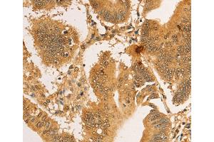 Immunohistochemistry (IHC) image for anti-Ribosomal Protein L26-Like 1 (RPL26L1) antibody (ABIN2422743) (RPL26L1 antibody)