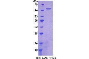 SDS-PAGE (SDS) image for High Temperature Requirement Factor A1 (AA 204-364) protein (His tag,GST tag) (ABIN1099162)