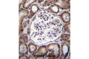 VPS54 Antibody (Center) immunohistochemistry analysis in formalin fixed and paraffin embedded human kidney tissue followed by peroxidase conjugation of the secondary antibody and DAB staining. (VPS54 antibody  (Middle Region))