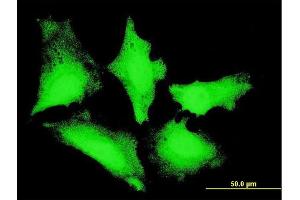 Immunofluorescence of monoclonal antibody to PIBF1 on HeLa cell. (PIBF1 antibody  (AA 660-755))