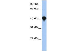 WB Suggested Anti-PTPLAD1 Antibody Titration:  0.