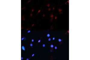 Immunofluorescence analysis of C6 using ZEB1 antibody (ABIN6129933, ABIN6150422, ABIN6150423 and ABIN6221237) at dilution of 1:100 (40x lens). (ZEB1 antibody  (AA 1-260))