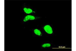 Immunofluorescence of monoclonal antibody to AATF on HeLa cell. (AATF antibody  (AA 151-250))