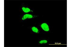 Immunofluorescence of monoclonal antibody to AATF on HeLa cell.