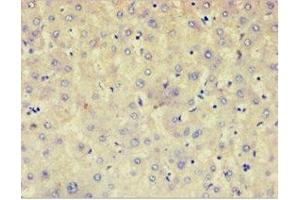 Immunohistochemistry of paraffin-embedded human liver tissue using ABIN7143031 at dilution of 1: 100