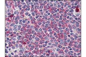 Immunohistochemistry: WNT5B antibody staining of Formalin-Fixed, Paraffin-Embedded Human Spleen. (WNT5B antibody)