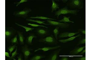 Immunofluorescence of purified MaxPab antibody to SMAD6 on HeLa cell. (SMAD6 antibody  (AA 1-496))