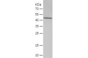 Western Blotting (WB) image for RAB27A, Member RAS Oncogene Family (RAB27A) (AA 1-221) protein (His-IF2DI Tag) (ABIN7284134) (RAB27A Protein (AA 1-221) (His-IF2DI Tag))