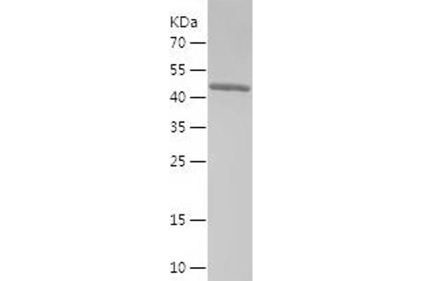 RAB27A Protein (AA 1-221) (His-IF2DI Tag)