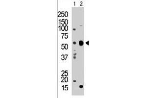 The PACSIN2 polyclonal antibody  is used in Western blot to detect PACSIN2 in T-47D cell lysate (Lane 1) and mouse brain tissue lysate (Lane 2) . (PACSIN2 antibody  (C-Term))