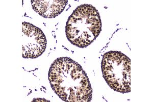 IHC analysis of POLR2A using anti-POLR2A antibody .