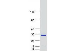 Validation with Western Blot (TREX2 Protein (Myc-DYKDDDDK Tag))