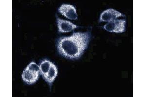 Immunofluorescence of AN3 CA cells (Human endometrial adenocarcinoma, ATCC HTB-111). (Sec8 antibody  (AA 31-201))