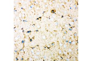 Anti- DHFR Picoband antibody,IHC(P) IHC(P): Mouse Brain Tissue (Dihydrofolate Reductase antibody  (AA 2-187))