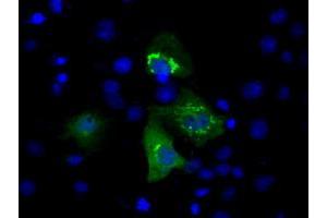 Immunofluorescence (IF) image for anti-Induced Myeloid Leukemia Cell Differentiation Protein Mcl-1 (MCL1) antibody (ABIN1499344) (MCL-1 antibody)