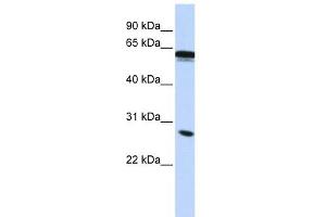 IGSF1 antibody used at 1 ug/ml to detect target protein. (IGSF1 antibody  (Middle Region))