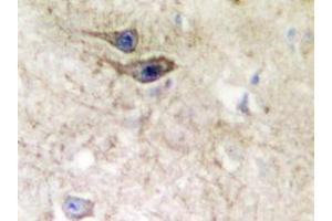 Immunohistochemistry analyzes of EphB1/2 antibody in paraffin-embedded human brain tissue. (EPH Receptor B1 antibody)