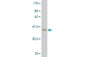 Western Blot detection against Immunogen (37. (STMN2 antibody  (AA 73-179))