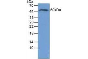 Western Blotting (WB) image for Interleukin 6 Receptor (IL6R) ELISA Kit (ABIN6730982)