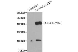 Western Blotting (WB) image for anti-Epidermal Growth Factor Receptor (EGFR) (pTyr869) antibody (ABIN1870109) (EGFR antibody  (pTyr869))