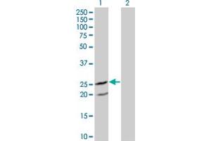 Western Blot analysis of IL6 expression in transfected 293T cell line by IL6 monoclonal antibody (M10), clone 4B12. (IL-6 antibody  (AA 29-212))