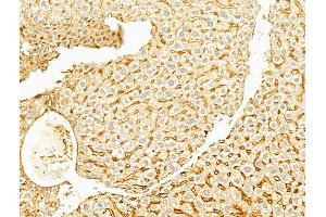 ABIN6256124 and ABIN6267537 at 1/100 staining Mouse liver tissue by IHC-P.