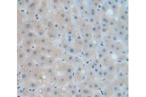 IHC-P analysis of Human Tissue, with DAB staining. (Complement Factor B antibody  (AA 477-600))