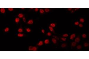 Immunofluorescence (fixed cells) (IF/ICC) image for anti-Protein Inhibitor of Activated STAT, 1 (PIAS1) (N-Term) antibody (ABIN6264195)