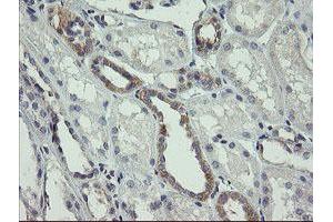 Immunohistochemistry (IHC) image for anti-ATP/GTP Binding Protein 1 (AGTPBP1) (AA 368-753) antibody (ABIN1491460)