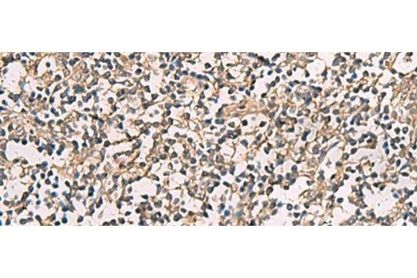 CMTM4 antibody