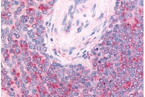 Human Spleen, Central Artery and Lymphocytes Within Periarteriolar Lymphoid Sheaths (formalin-fixed, paraffin-embedded) stained with c-Kit antibody ABIN213610 at 20 ug/ml followed by biotinylated goat anti-rabbit IgG secondary antibody ABIN481713, alkaline  . (KIT antibody  (Extracellular Domain))